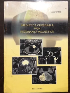 OPRIS LIGIA - IMAGISTICA CEREBRALA PRIN REZONANTA MAGNETICA