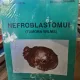 Nefroblastomul - Tumora Wilms - Corneliu Sabetay, Bogdan Zaharia