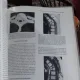 THORACOLUMBAR SPINE FRACTURES - YIZHAR FLOMAN