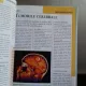 CREIERUL SI ORGANELE DE SIMT - LAROUSSE. ENCICLOPEDIA MEDICALA A FAMILIEI