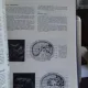 ATLAS COMENTAT DE ECOGRAFIE ABDOMINALA - GH. BADEA