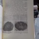MORFOPATOLOGIA - I. GEORGESCU