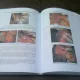TRANSPLANTUL HEPATIC - IRINEL POPESCU