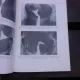 HISTEROSALPINOGRAFIA IN PRACTICA GINECOLOGICA SI OBSTETRICALA, ATLAS - PAULA CONSTANTINESCU