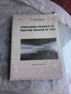 Stabilizarea focarului in fractura dechisa de tibie - Mihai Popescu