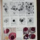 DIAGNOSTICUL HEMATOLOGIC VOL. I /VOL II- R.TANASESCU